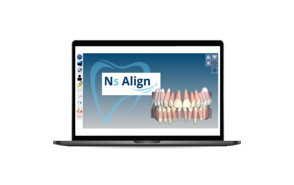 Ordinateur logiciel NS Align